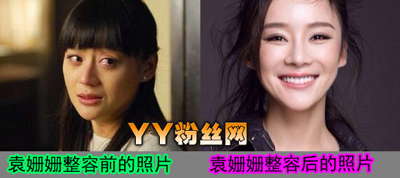 袁姗姗个人资料背景写真照片,袁姗姗整容前后照片对比