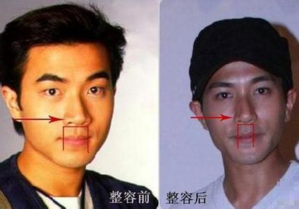 刘恺威杨幂整容前照片,刘恺威杨幂差几岁,杨幂刘恺威哪里整容了图 杨幂发现刘恺威整容