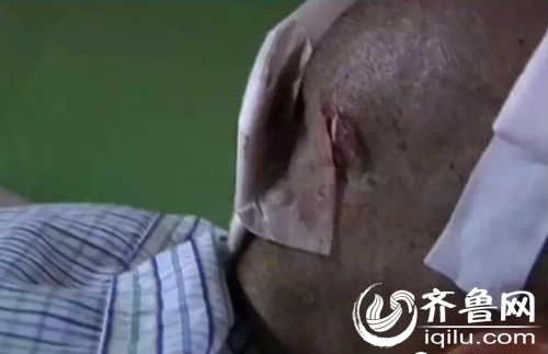 网曝一老人遭虐待殴打 南京老人遭老外殴打 老人被儿子殴打重伤