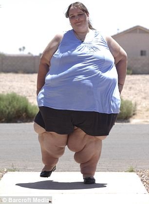 中国首胖东北女子体重488斤 世界最胖女体重破1400斤