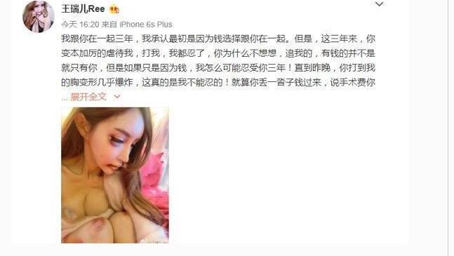 网红王瑞儿遭男友家暴虐待现场视频图,王瑞儿百万假胸打变形照片