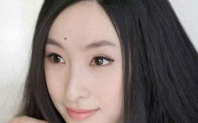 富贵痣的3个位置女人身上最好的痣,不会癌变痣皮肤癌一般位置