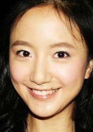 富贵痣的3个位置女人身上最好的痣,不会癌变痣皮肤癌一般位置