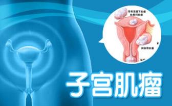 子宫肌瘤早期信号有哪些,子宫肌瘤忌口食物最怕的4种食物