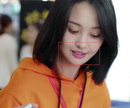 郑爽的嘴巴怎么回事 郑爽的嘴巴怎么怪怪的