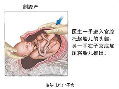 孕妇在产房生孩子视频 女人产房尴尬照 产妇产房解剖图片