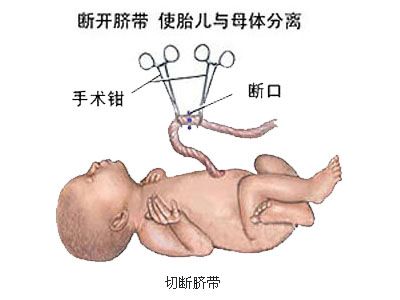 孕妇在产房生孩子视频 女人产房尴尬照 产妇产房解剖图片