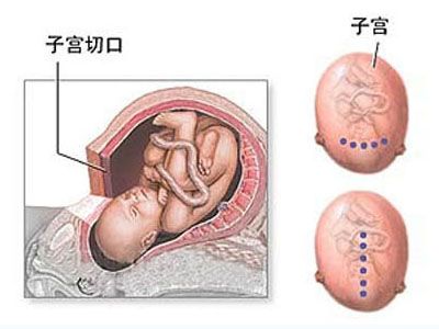 孕妇在产房生孩子视频 女人产房尴尬照 产妇产房解剖图片