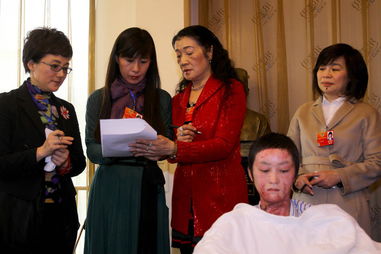 合肥被毁容少女周岩原因真相照片 毁容少女周岩近况最新情况