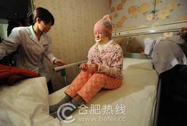 合肥被毁容少女周岩原因真相照片 毁容少女周岩近况最新情况