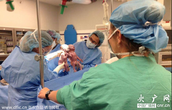 双胞胎女婴遭割喉被弃垃圾桶后夭折,美国女生双胞胎牵手出生图片
