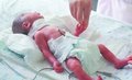 双胞胎女婴遭割喉被弃垃圾桶后夭折,美国女生双胞胎牵手出生图片