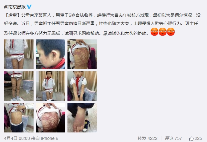 南京虐童案鉴定结果出炉再转折 南京虐童事件始末及反思原因