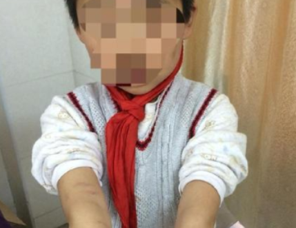 南京虐童案鉴定结果出炉再转折 南京虐童事件始末及反思原因