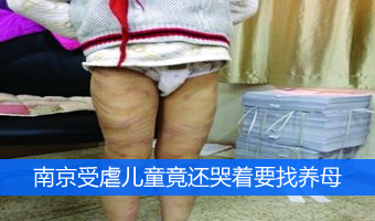 南京虐童案鉴定结果出炉再转折 南京虐童事件始末及反思原因