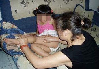 4岁女孩被父亲灼烫虐待图 盘点那些严重父母虐童事件图