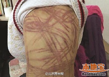 网曝湖南邵阳发生恶性虐童事件 南京虐童事件始末最新进展