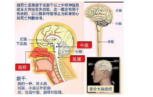 留学生堕胎被治成脑死亡 脑死亡和植物人的区别是什么