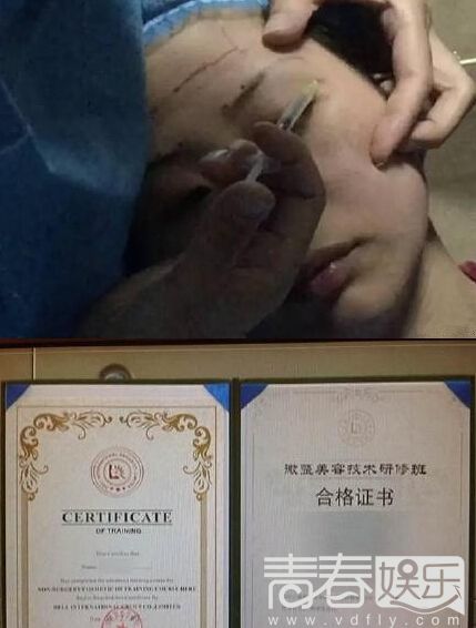 微整形行业内幕曝光图 注射玻尿酸微整形的危害有哪些图