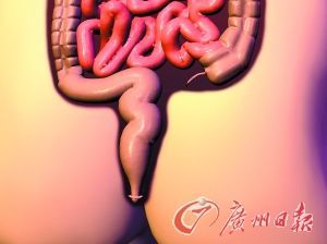 警惕结直肠癌疾病的早期症兆 中国结直肠癌发病率是多少
