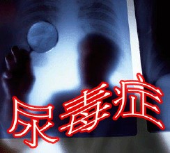 男子患尿毒症母亲却拒换肾 尿毒症的症状换肾要多少费用