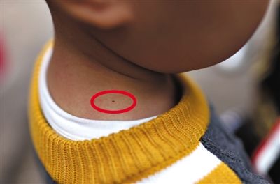 关于幼儿园针扎事件的反思 幼儿园老师虐童事件盘点