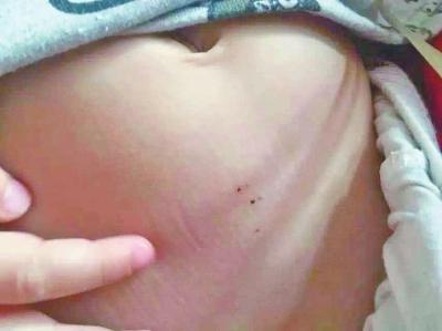 关于幼儿园针扎事件的反思 幼儿园老师虐童事件盘点