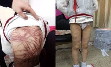 关于幼儿园针扎事件的反思 幼儿园老师虐童事件盘点