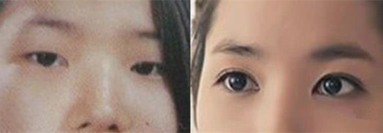 朴敏英整容前后照片遭扒网友吐槽:辣眼睛!朴叙俊朴敏英恋情再添