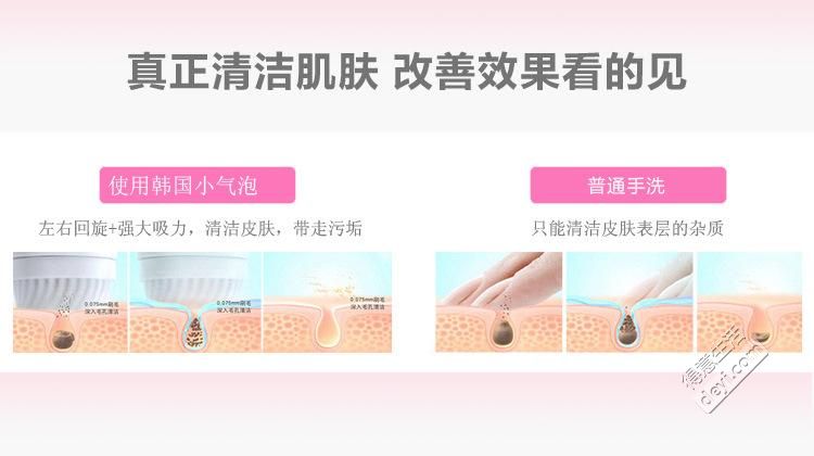 韩国小气泡深层清洁危害骗局曝光 小气泡多少钱一次去除黑头视频