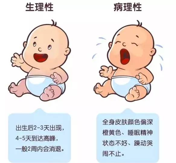 去黄疸最快方法消退只用四招 黄疸正常范围是多少超过多少入脑