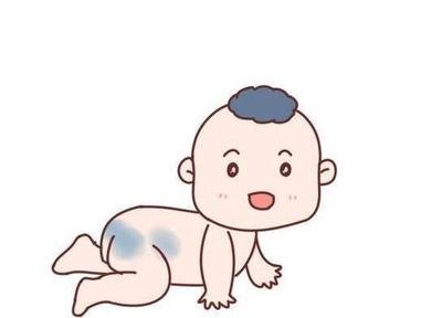 宝宝有胎记的原因佛说有胎记的孩子 胎记图片大全图解