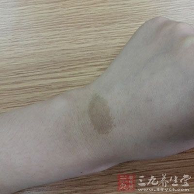宝宝有胎记的原因佛说有胎记的孩子 胎记图片大全图解