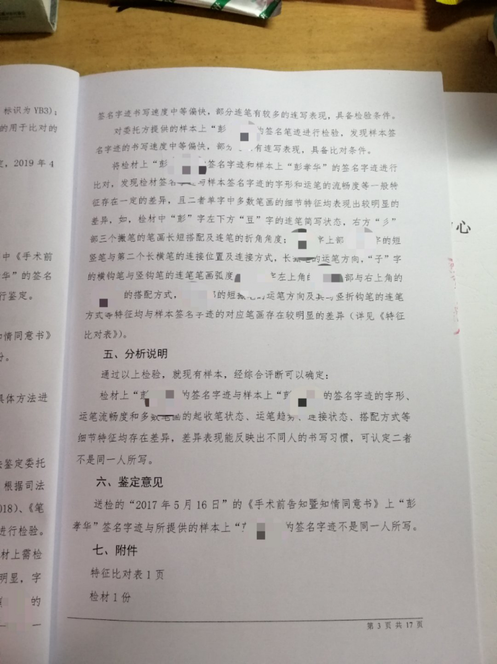 震惊!研究生整形双眼皮竟成大小眼 整容风险太大!