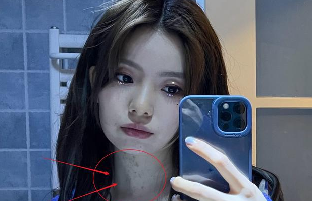 陈卓璇的脖子怎么回事儿,陈卓璇家里是干什么的家庭背景介绍