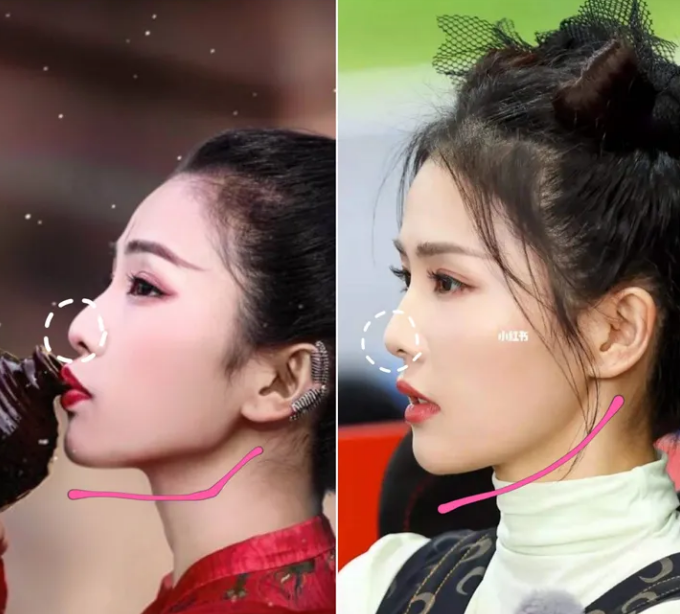 白鹿是不是整容了扒扒白鹿整容原因真相,白鹿整容前照片遭曝光!